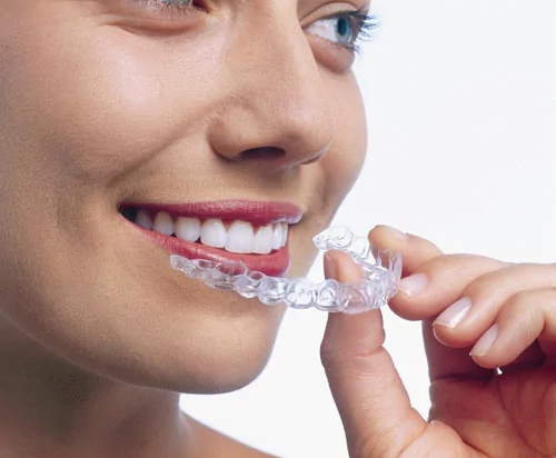 get straight teeth using clear braces with an Indianapolis dentist in Fishers