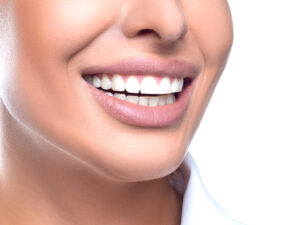 Same day smile makeover with veneers in Indianapolis